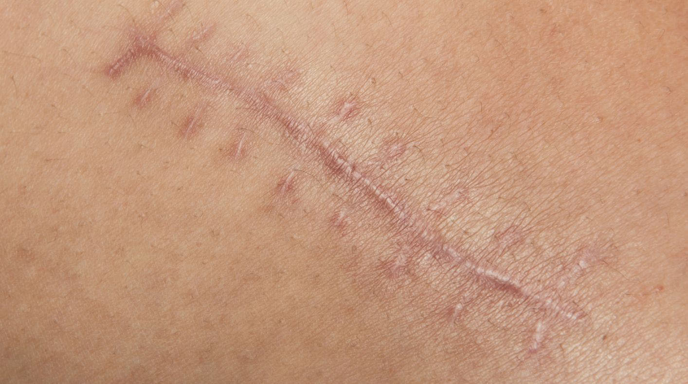 Massage assis, Patricia Rebetez